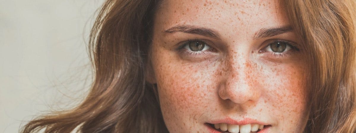 Teen Skincare Routine For Clear, Healthy Skin
