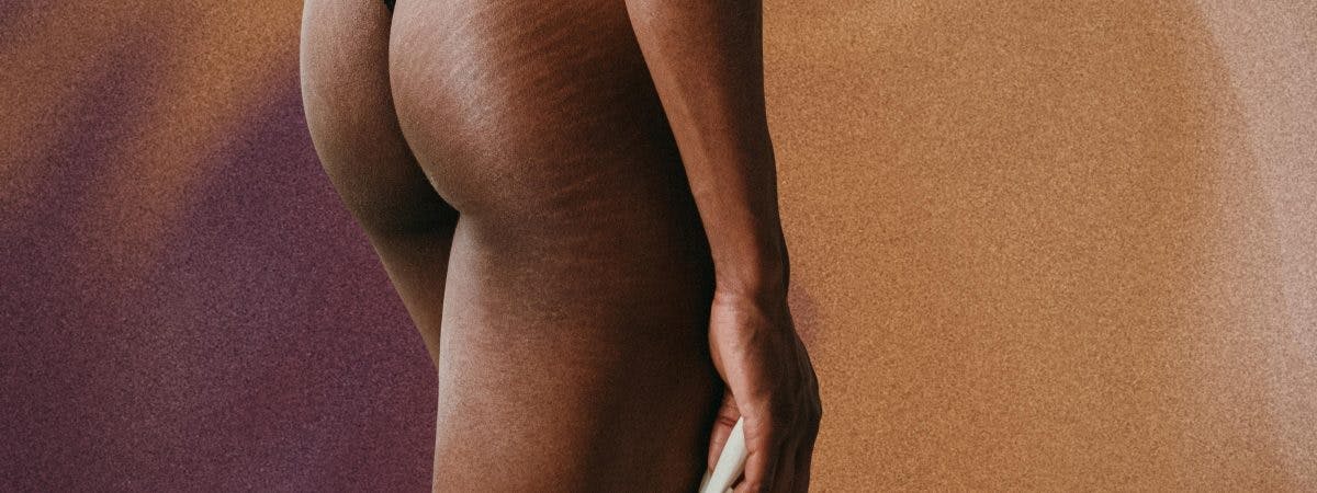Do Stretchmarks Go Away? Here’s What Experts Say  