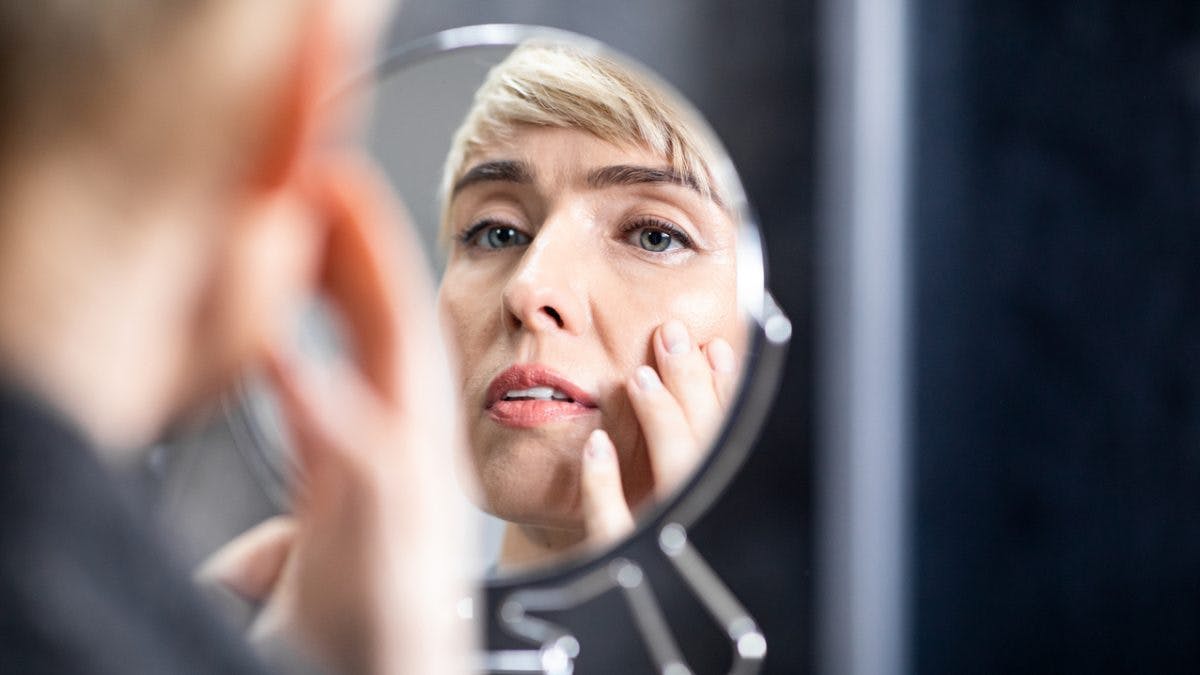 skin flaking woman with short blonde hair looking in the mirror
